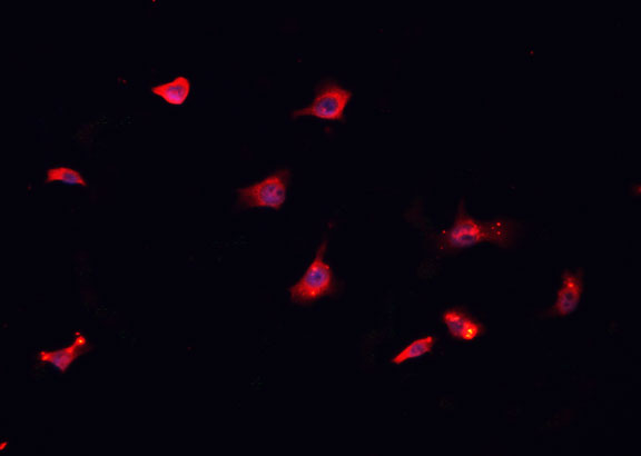 CD151 Antibody - Staining HepG2 cells by IF/ICC. The samples were fixed with PFA and permeabilized in 0.1% Triton X-100, then blocked in 10% serum for 45 min at 25°C. The primary antibody was diluted at 1:200 and incubated with the sample for 1 hour at 37°C. An Alexa Fluor 594 conjugated goat anti-rabbit IgG (H+L) antibody, diluted at 1/600, was used as secondary antibody.