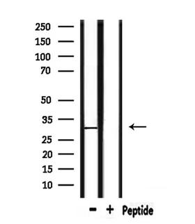 CD151 Antibody - Western blot analysis of extracts of mouse muscle using CD151 antibody.