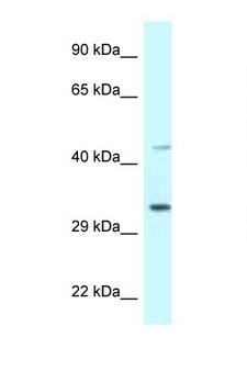 CD157 Antibody - BST1 antibody Western blot of COL0205 Cell lysate. Antibody concentration 1 ug/ml.  This image was taken for the unconjugated form of this product. Other forms have not been tested.