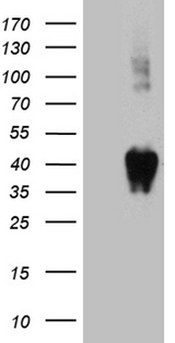 CD157 Antibody - HEK293T cells were transfected with the pCMV6-ENTRY control. (Left lane) or pCMV6-ENTRY BST1. (Right lane) cDNA for 48 hrs and lysed