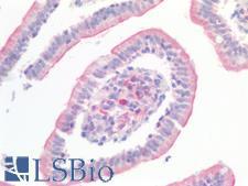 CD157 Antibody - Human Small Intestine: Formalin-Fixed, Paraffin-Embedded (FFPE)