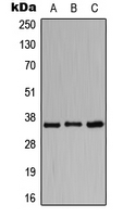 CD157 Antibody - Western blot analysis of CD157 expression in HeLa (A); Raw264.7 (B); H9C2 (C) whole cell lysates.