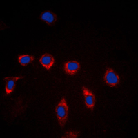CD157 Antibody - Immunofluorescent analysis of CD157 staining in Raw264.7 cells. Formalin-fixed cells were permeabilized with 0.1% Triton X-100 in TBS for 5-10 minutes and blocked with 3% BSA-PBS for 30 minutes at room temperature. Cells were probed with the primary antibody in 3% BSA-PBS and incubated overnight at 4 C in a humidified chamber. Cells were washed with PBST and incubated with a DyLight 594-conjugated secondary antibody (red) in PBS at room temperature in the dark. DAPI was used to stain the cell nuclei (blue).