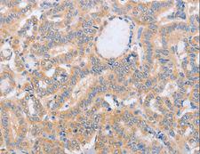 CD157 Antibody - Immunohistochemistry of paraffin-embedded Human brain using BST1 Polyclonal Antibody at dilution of 1:40.