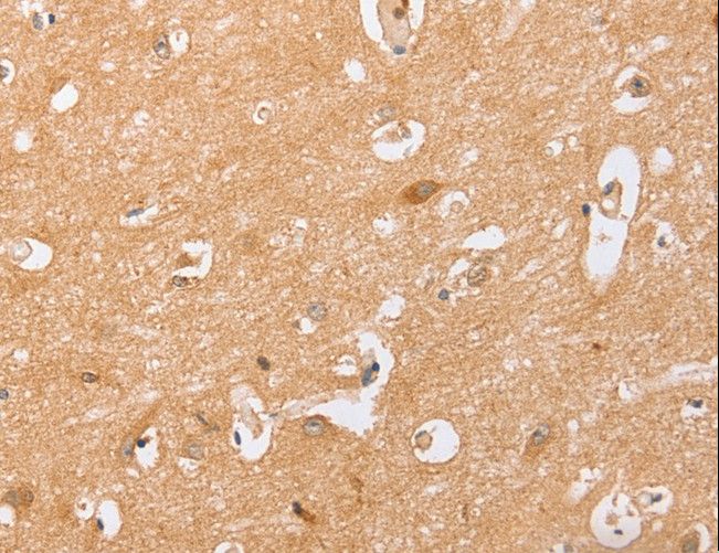 CD157 Antibody - Immunohistochemistry of paraffin-embedded Human brain using BST1 Polyclonal Antibody at dilution of 1:40.