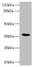 CD157 Antibody - Western blot All Lanes: BST1 antibody IgG at 1.47ug/ml+ Mouse lung tissue Secondary Goat polyclonal to rabbit IgG at 1/10000 dilution Predicted band size: 36,30 kDa Observed band size: 36 kDa
