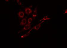 CD157 Antibody - Staining HeLa cells by IF/ICC. The samples were fixed with PFA and permeabilized in 0.1% Triton X-100, then blocked in 10% serum for 45 min at 25°C. The primary antibody was diluted at 1:200 and incubated with the sample for 1 hour at 37°C. An Alexa Fluor 594 conjugated goat anti-rabbit IgG (H+L) Ab, diluted at 1/600, was used as the secondary antibody.