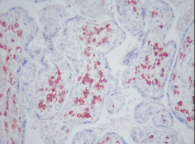 CD163 Antibody - IHC of CD163 antibody. Formalin-fixed, paraffin-embedded human placenta.