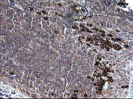 CD163 Antibody - IHC of paraffin-embedded Human lymph node tissue using anti-CD163 mouse monoclonal antibody. (Heat-induced epitope retrieval by 10mM citric buffer, pH6.0, 120°C for 3min).