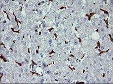 CD163 Antibody - IHC of paraffin-embedded Human liver tissue using anti-CD163 mouse monoclonal antibody. (Heat-induced epitope retrieval by 10mM citric buffer, pH6.0, 120°C for 3min).