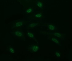CD163 Antibody - Immunofluorescent staining of HeLa cells using anti-CD163 mouse monoclonal antibody.