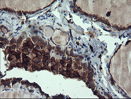 CD163 Antibody - IHC of paraffin-embedded Human thyroid tissue using anti-CD163 mouse monoclonal antibody.
