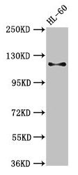 CD163 Antibody - Western Blot Positive WB detected in: HL60 whole cell lysate All lanes: Cd163 antibody at 3µg/ml Secondary Goat polyclonal to rabbit IgG at 1/50000 dilution Predicted band size: 121, 126 kDa Observed band size: 121 kDa