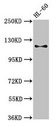 CD163 Antibody - Western Blot Positive WB detected in: HL60 whole cell lysate All lanes: Cd163 antibody at 3µg/ml Secondary Goat polyclonal to rabbit IgG at 1/50000 dilution Predicted band size: 121, 126 kDa Observed band size: 121 kDa