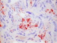 CD163 Antibody - CD163 polyclonal human placenta, frozen section