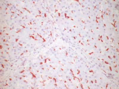 CD163 Antibody - CD163 polyclonal swine liver, frozen section