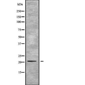 CD164 Antibody - Western blot analysis of CD164 using HuvEc whole cells lysates