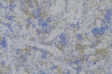 CD164 Antibody - 1:100 staining human lymph node tissue by IHC-P. The sample was formaldehyde fixed and a heat mediated antigen retrieval step in citrate buffer was performed. The sample was then blocked and incubated with the antibody for 1.5 hours at 22°C. An HRP conjugated goat anti-rabbit antibody was used as the secondary.