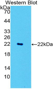 CD177 Antibody - Western blot of recombinant CD177.