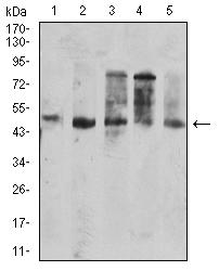 CD177 Antibody - Western blot analysis using CD177 mouse mAb against SPC-A-1 (1), SK-MES-1 (2), HepG2 (3), HL-60 (4), and PC-3 (5) cell lysate.