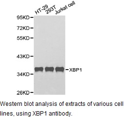 CD177 Antibody - Western blot.