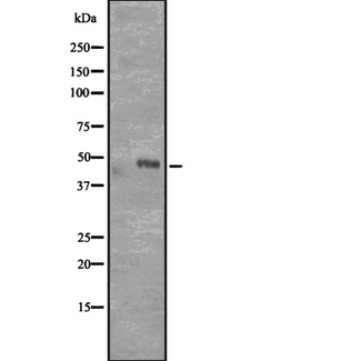 CD177 Antibody - Western blot analysis of CD177 expression in Transfected 293T cells lysate. The lane on the left is treated with the antigen-specific peptide.