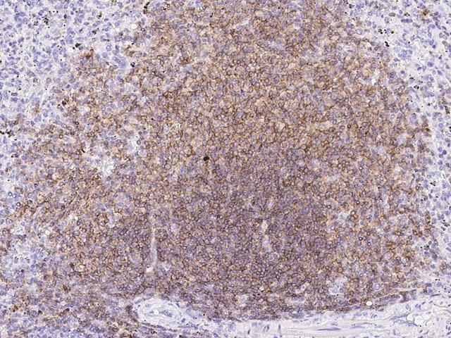 CD19 Antibody - Immunochemical staining of human CD19 in human spleen with mouse monoclonal antibody(11:200, formalin-fixed paraffin embedded sections).