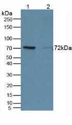 CD19 Antibody - Western Blot; Sample. Lane1: Mouse Kidney Tissue; Lane2: Rat Marrow Tissue.