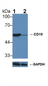 CD19 Antibody - Knockout Varification: Lane 1: Wild-type Raji cell lysate; Lane 2: CD19 knockout Raji cell lysate; Predicted MW: 60kDa Observed MW: 54kDa Primary Ab: 1µg/ml Rabbit Anti-Mouse CD19 Antibody Second Ab: 0.2µg/mL HRP-Linked Caprine Anti-Rabbit IgG Polyclonal Antibody