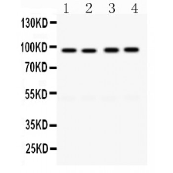CD19 Antibody - CD19 antibody Western blot. All lanes: Anti CD19 at 0.5 ug/ml. Lane 1: RAJI Whole Cell Lysate at 40 ug. Lane 2: A549 Whole Cell Lysate at 40 ug. Lane 3: MCF-7 Whole Cell Lysate at 40 ug. Lane 4: SW620 Whole Cell Lysate at 40 ug. Predicted band size: 90 kD. Observed band size: 90 kD.