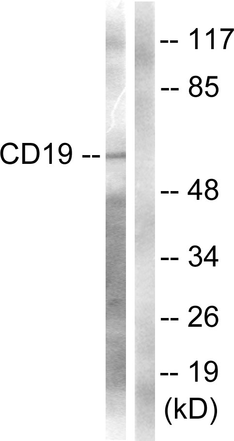 CD19 Antibody - Western blot analysis of lysates from COS7 cells, treated with Serum 10% 30', using CD19 Antibody. The lane on the right is blocked with the synthesized peptide.
