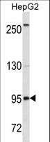 CD19 Antibody - CD19 Antibody western blot of HepG2 cell line lysates (35 ug/lane). The CD19 antibody detected the CD19 protein (arrow).