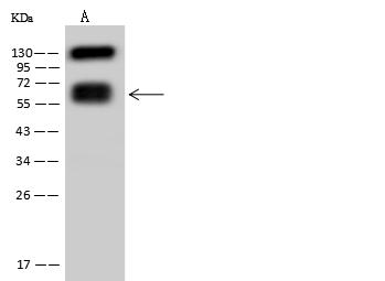 CD19 Antibody - Anti-CD19 mouse monoclonal antibody at 1:500 dilution. Lane A: Daudi Whole Cell Lysate. Lysates/proteins at 30 ug per lane. Secondary: Goat Anti-Mouse IgG (H+L)/HRP at 1/10000 dilution. Developed using the ECL technique. Performed under reducing conditions. Predicted band size: 61 kDa. Observed band size: 61 kDa. (We are unsure as to the identity of these extra bands.)