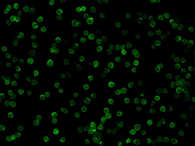 CD19 Antibody - Immunofluorescence staining of CD19 in Raji cells. Cells were fixed with 4% PFA, blocked with 10% serum, and incubated with mouse anti-human CD19 monoclonal antibody (dilution ratio 1:60) at 4°C overnight. Then cells were stained with the Alexa Fluor 488-conjugated Goat Anti-mouse IgG secondary antibody (green). Positive staining was localized to Cytoplasm and Cell membrane.