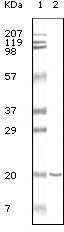 CD19 Antibody - CD19 Antibody in Western Blot (WB)