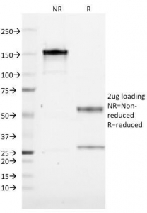 CD19 Antibody - SDS-PAGE Analysis of Purified, BSA-Free CD19 Antibody (clone CVID3/155). Confirmation of Integrity and Purity of the Antibody.