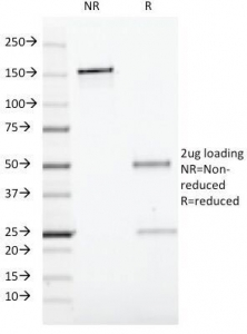 CD19 Antibody - SDS-PAGE Analysis of Purified, BSA-Free CD19 Antibody (clone CVID3/429). Confirmation of Integrity and Purity of the Antibody.
