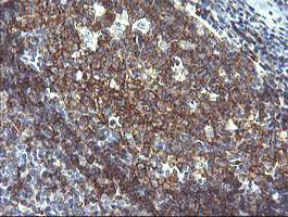 CD19 Antibody - IHC of paraffin-embedded Human tonsil using anti-CD19 mouse monoclonal antibody. (Heat-induced epitope retrieval by 10mM citric buffer, pH6.0, 120°C for 3min).
