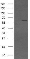 CD19 Antibody - HEK293T cells were transfected with the pCMV6-ENTRY control (Left lane) or pCMV6-ENTRY CD19 (Right lane) cDNA for 48 hrs and lysed. Equivalent amounts of cell lysates (5 ug per lane) were separated by SDS-PAGE and immunoblotted with anti-CD19.