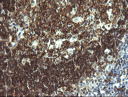 CD19 Antibody - IHC of paraffin-embedded Human tonsil using anti-CD19 mouse monoclonal antibody. (Heat-induced epitope retrieval by 10mM citric buffer, pH6.0, 120°C for 3min).