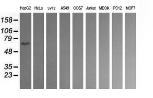 CD19 Antibody - Western blot of extracts (35 ug) from 9 different cell lines by using anti-CD19 monoclonal antibody (HepG2: human; HeLa: human; SVT2: mouse; A549: human; COS7: monkey; Jurkat: human; MDCK: canine; PC12: rat; MCF7: human).
