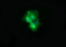 CD19 Antibody - Anti-CD19 mouse monoclonal antibody immunofluorescent staining of COS7 cells transiently transfected by pCMV6-ENTRY CD19.