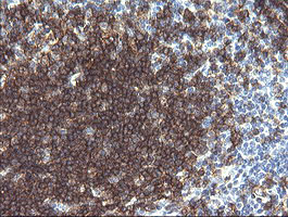 CD19 Antibody - IHC of paraffin-embedded Human tonsil using anti-CD19 mouse monoclonal antibody.