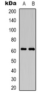 CD19 Antibody - Western blot analysis of CD19 expression in Jurkat (A); mouse brain (B) whole cell lysates.