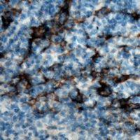 CD19 Antibody - Immunohistochemical analysis of CD19 staining in human tonsil formalin fixed paraffin embedded tissue section. The section was pre-treated using heat mediated antigen retrieval with sodium citrate buffer (pH 6.0). The section was then incubated with the antibody at room temperature and detected using an HRP polymer system. DAB was used as the chromogen. The section was then counterstained with hematoxylin and mounted with DPX.