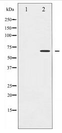 CD19 Antibody - Western blot of CD19 expression in Serum treated COS7 whole cell lysates,The lane on the left is treated with the antigen-specific peptide.