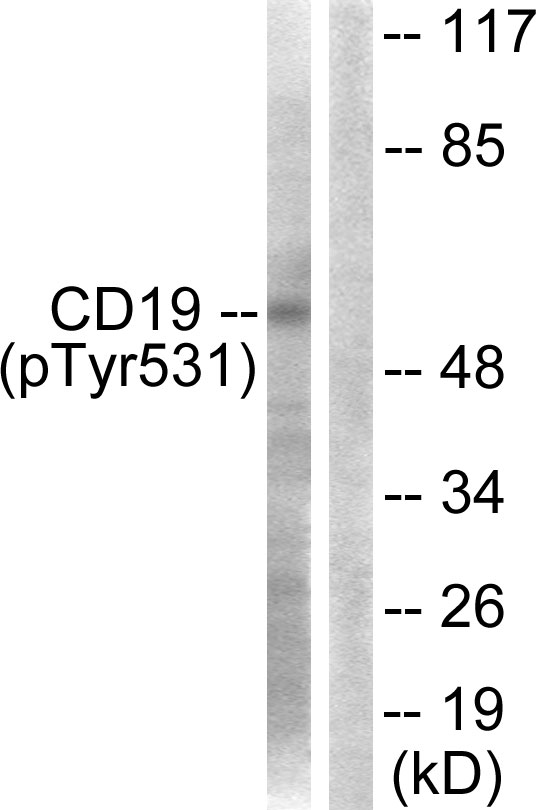 CD19 Antibody - Western blot analysis of lysates from COS7 cells treated with Serum 10% 30', using CD19 (Phospho-Tyr531) Antibody. The lane on the right is blocked with the phospho peptide.