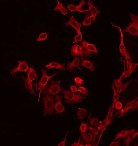 CD19 Antibody - Staining HeLa cells by IF/ICC. The samples were fixed with PFA and permeabilized in 0.1% Triton X-100, then blocked in 10% serum for 45 min at 25°C. The primary antibody was diluted at 1:200 and incubated with the sample for 1 hour at 37°C. An Alexa Fluor 594 conjugated goat anti-rabbit IgG (H+L) Ab, diluted at 1/600, was used as the secondary antibody.