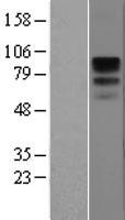 CD19 Protein - Western validation with an anti-DDK antibody * L: Control HEK293 lysate R: Over-expression lysate