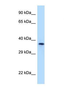 CD1A Antibody - CD1A antibody Western blot of 721_B Cell lysate. Antibody concentration 1 ug/ml.  This image was taken for the unconjugated form of this product. Other forms have not been tested.